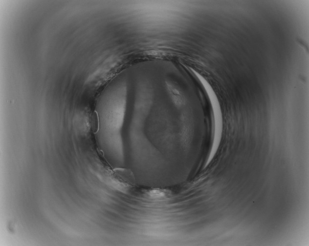 X0000099380566200805151621