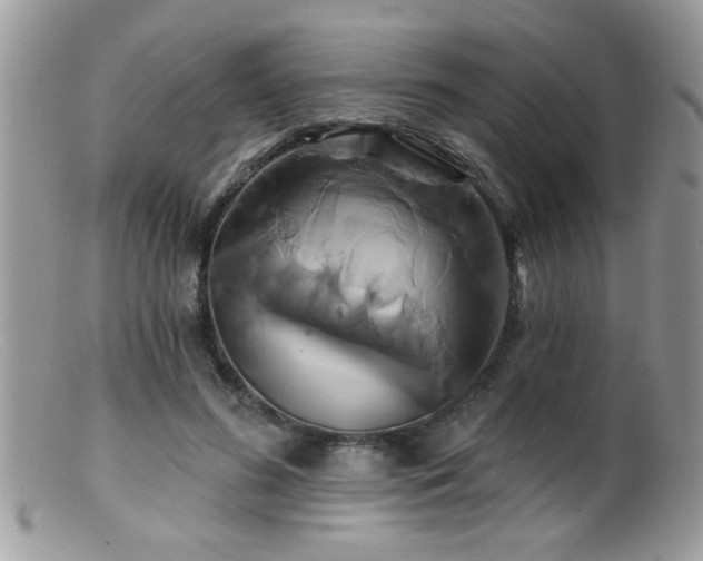 X0000099380596200805151620