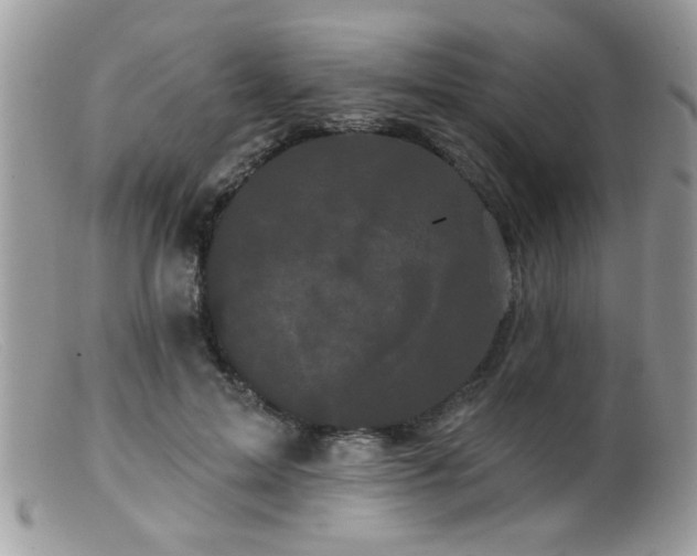 X0000099380599200805151620