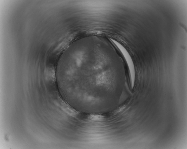 X0000099380617200805151620