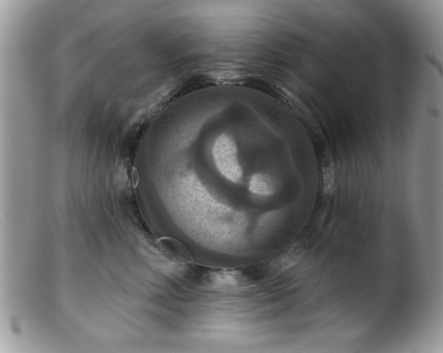 X0000099380618200805151620