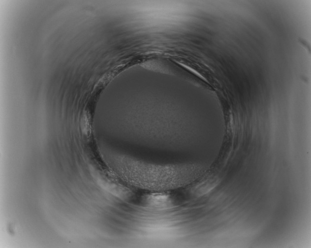 X0000099380651200805151619