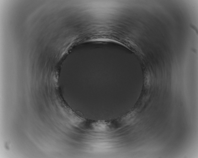 X0000099380661200805151620