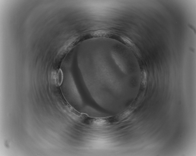 X0000099380669200805151620