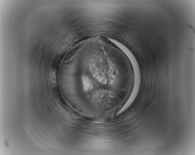 X0000099380699200805151619