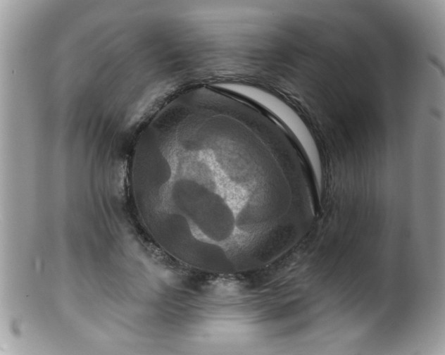 X0000099380742200805151618