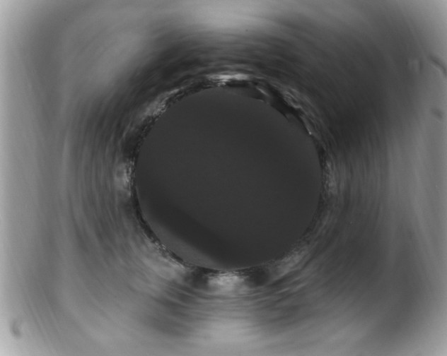 X0000099380759200805151618