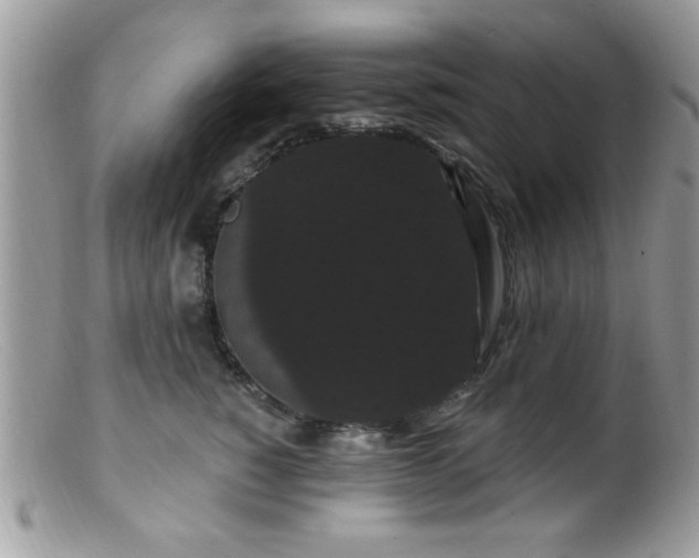 X0000099380760200805151618