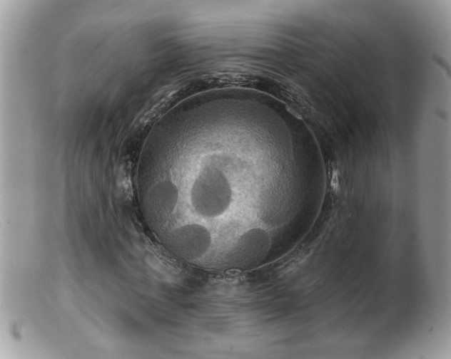 X0000099380771200805151618