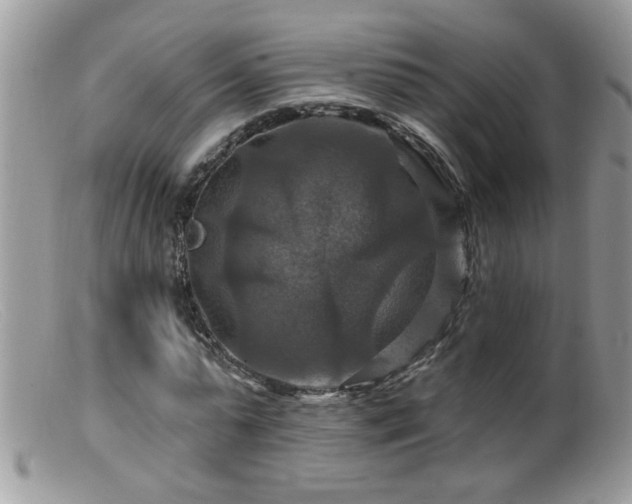 X0000099380775200805151617