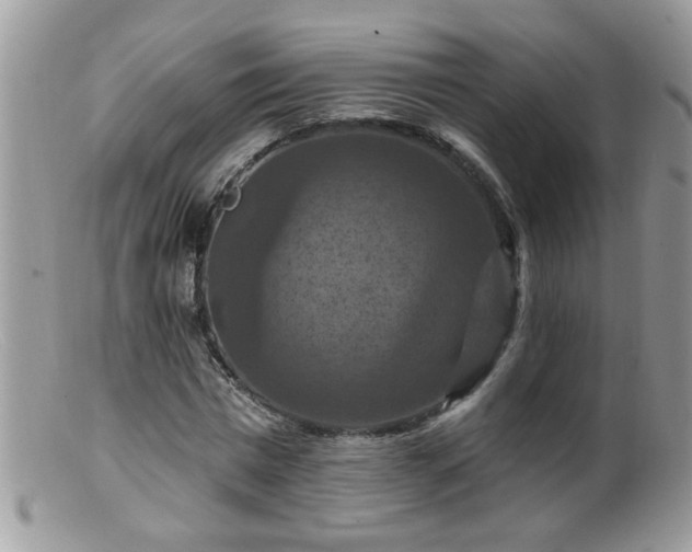 X0000099380777200805151617