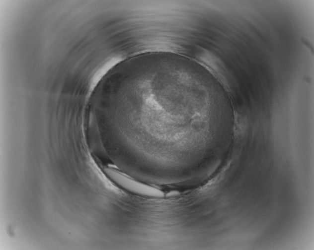 X0000099380804200805151617