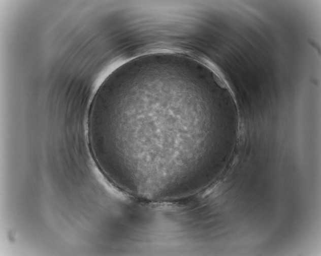 X0000099380811200805151617