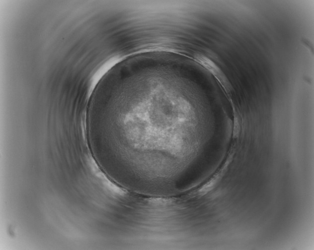 X0000099380812200805151617