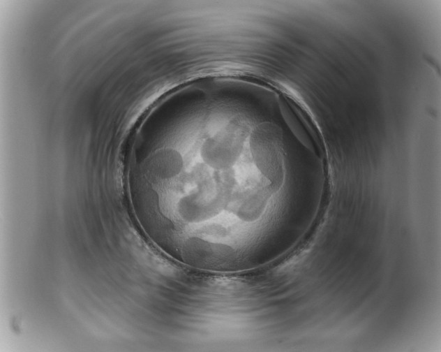 X0000099380835200805151616