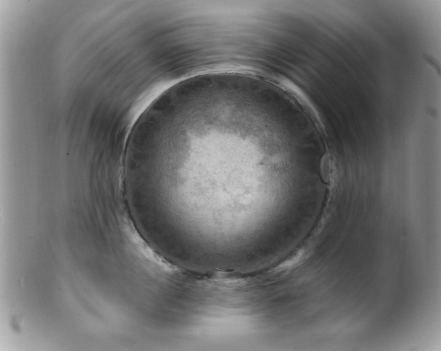 X0000099380860200805151617