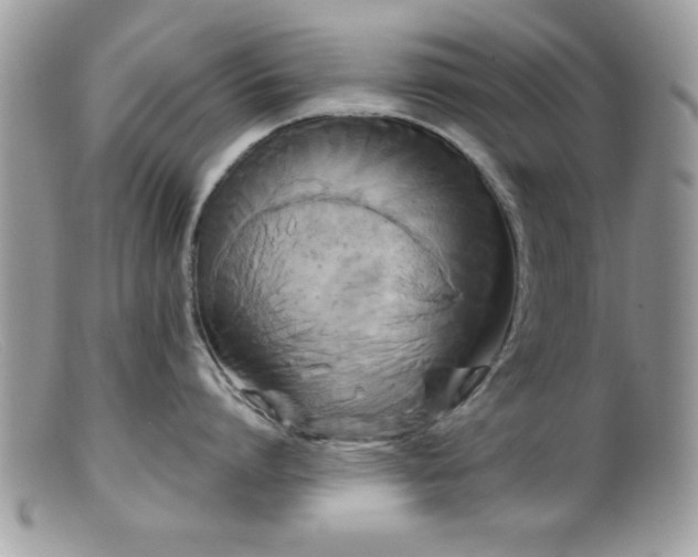 X0000099380864200805151617