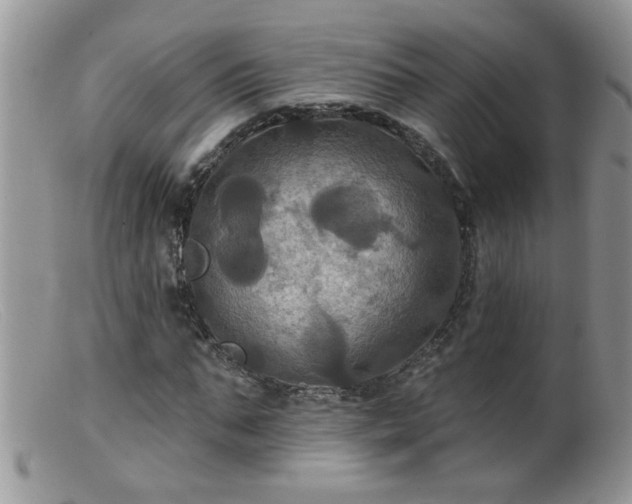 X0000099380871200805151616