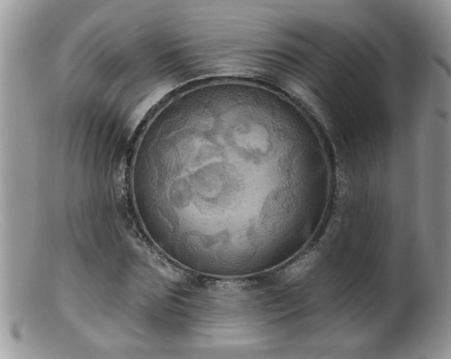 X0000099380875200805151616