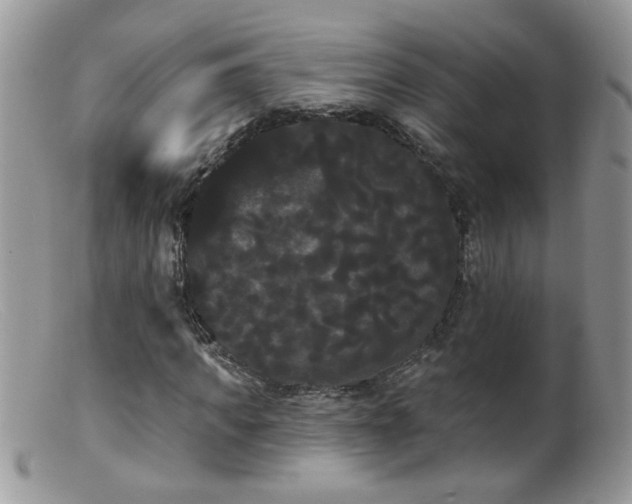 X0000099380917200805151615