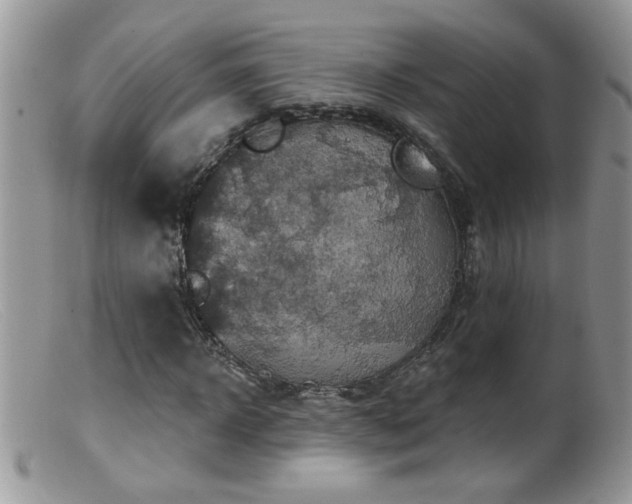 X0000099380918200805151615