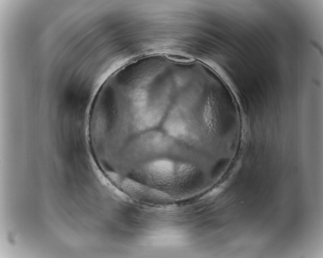 X0000099380957200805151615