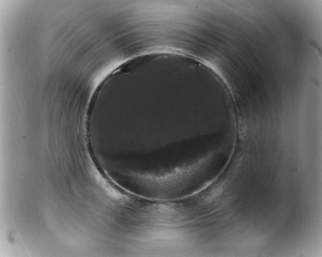 X0000099380995200805151614