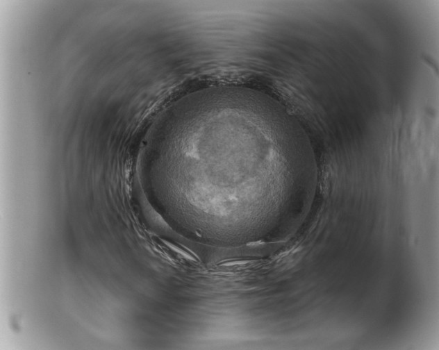 X0000099381010200805151613