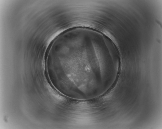 X0000099381028200805151613