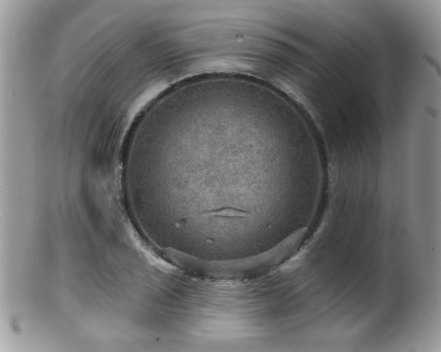 X0000099381029200805151613