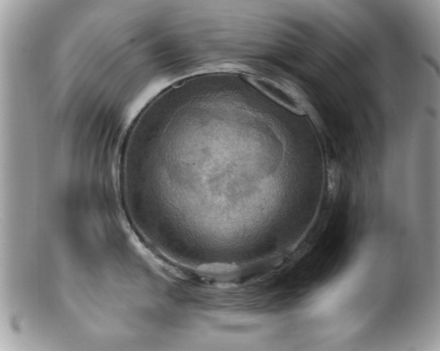 X0000099381054200805151614