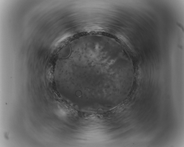 X0000099381063200805151613