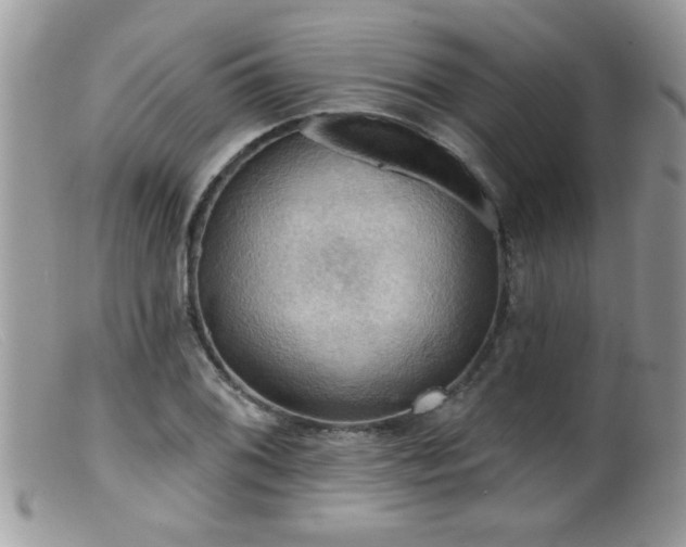 X0000099381076200805151613