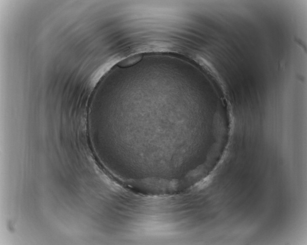 X0000099381081200805151613