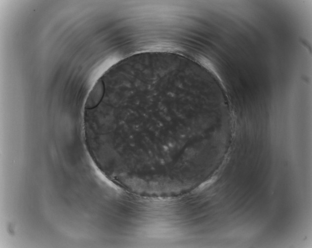 X0000099381087200805151613