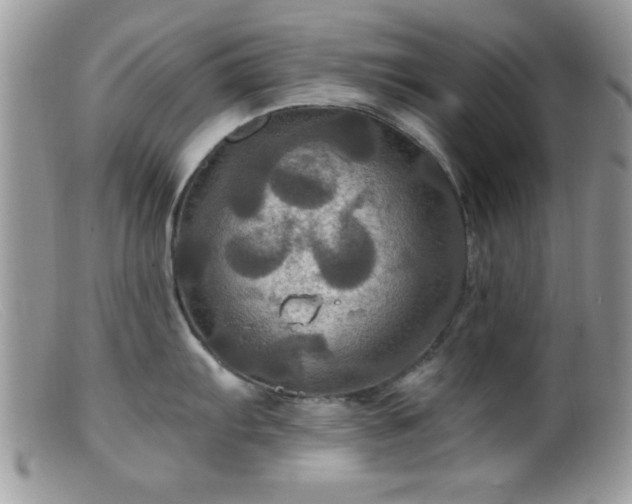 X0000099381103200805151612