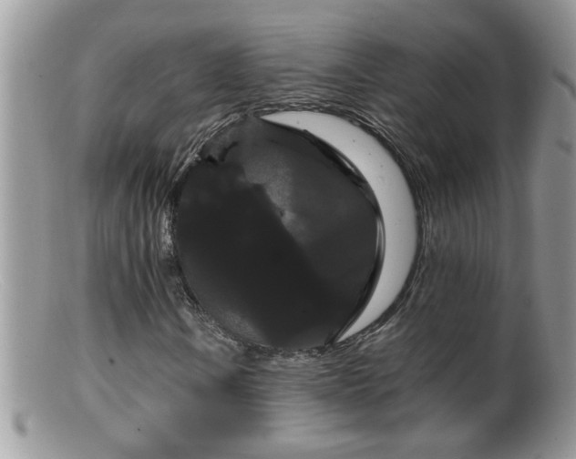 X0000099381106200805151612