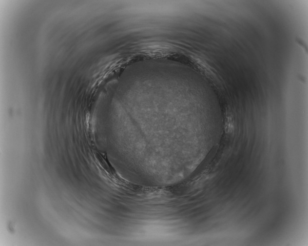 X0000099381108200805151612