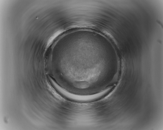 X0000099381114200805151612