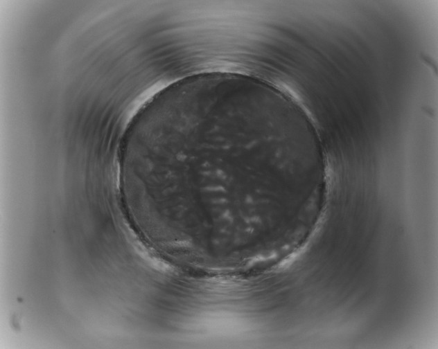 X0000099381125200805151612