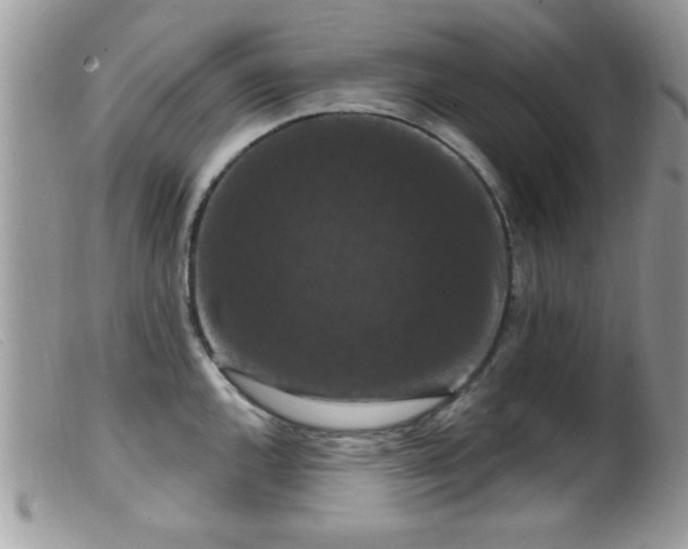 X0000099381144200805151612