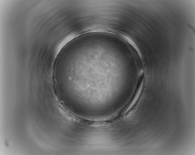 X0000099381146200805151612