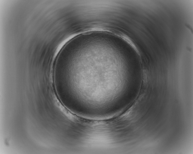 X0000099381148200805151612