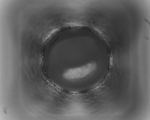 X0000099381157200805151611