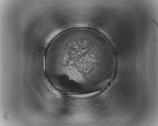 X0000099381171200805151611