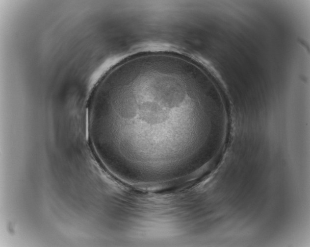 X0000099381175200805151611