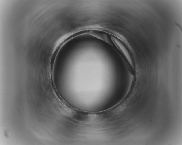 X0000099381176200805151611