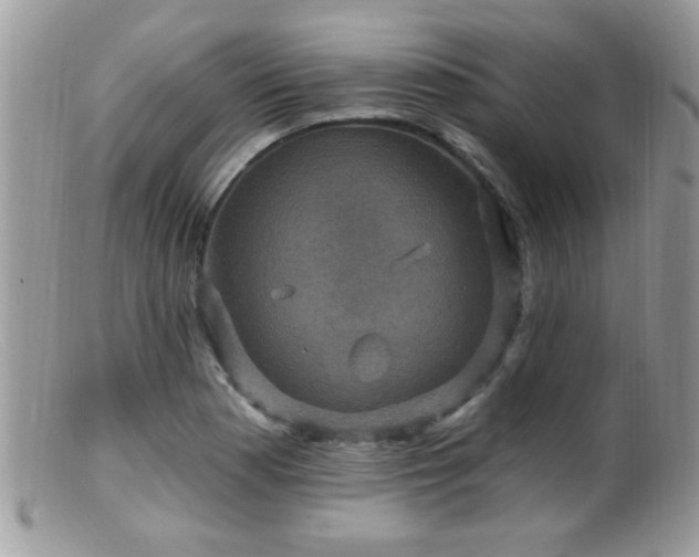 X0000099381177200805151611