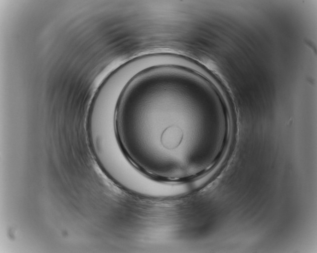 X0000099381181200805151611