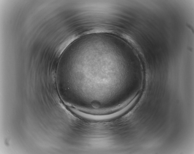 X0000099381185200805151611